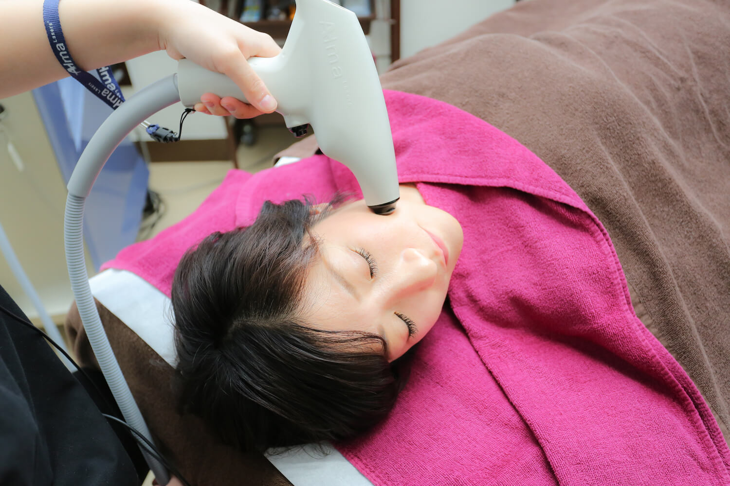 美容施術「テノールNEO」のたるみ改善効果（大阪梅田院） - 大阪の美容皮膚科 …