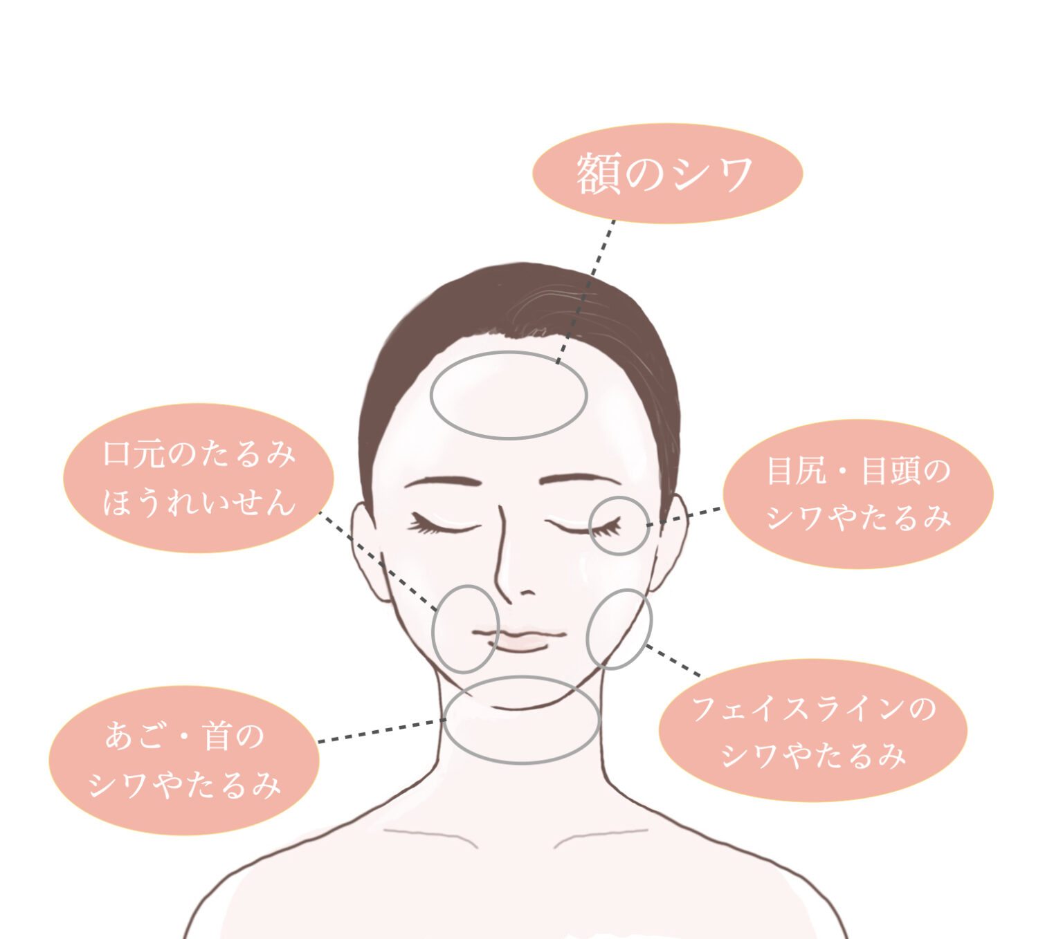 美容施術「テノール」を5年続けたときの効果 - 東京・大 …