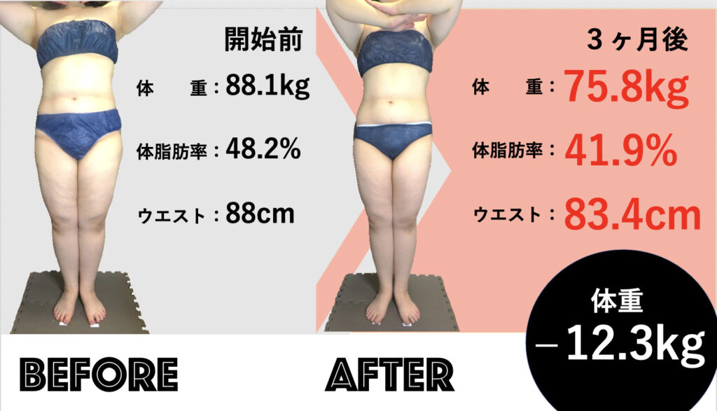 脂肪を減らす医療用ems 大阪院 東京 大阪の美容皮膚科ならflalu フラルクリニック