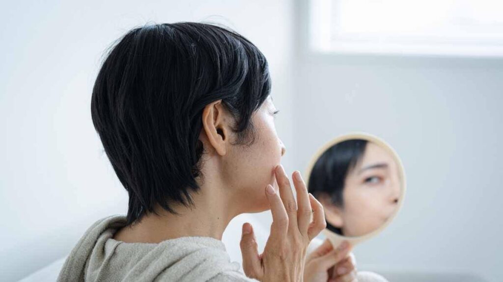 炎症後色素沈着