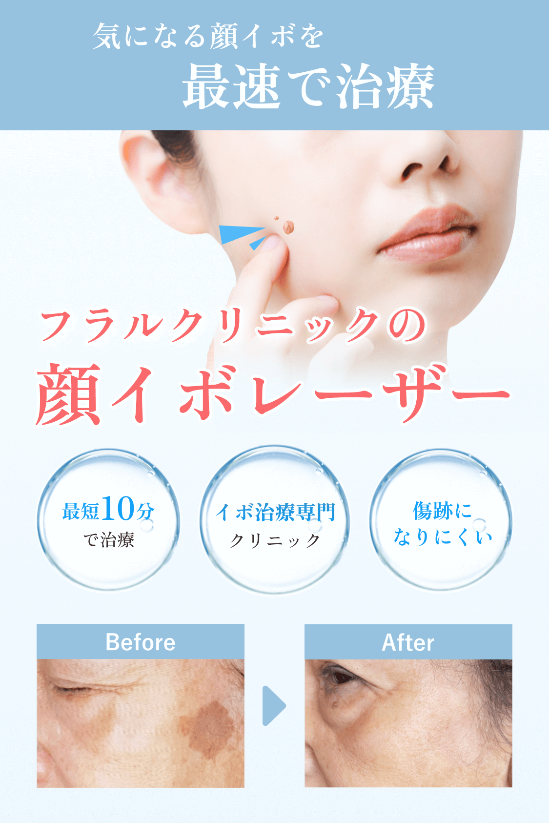 裁断済】スキルアップ皮膚レーザー治療 裁断済】スキルアップ皮膚