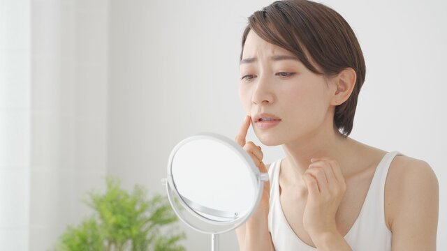 炎症後色素沈着とは