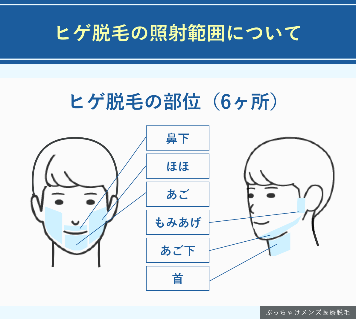 ヒゲ脱毛の照射範囲