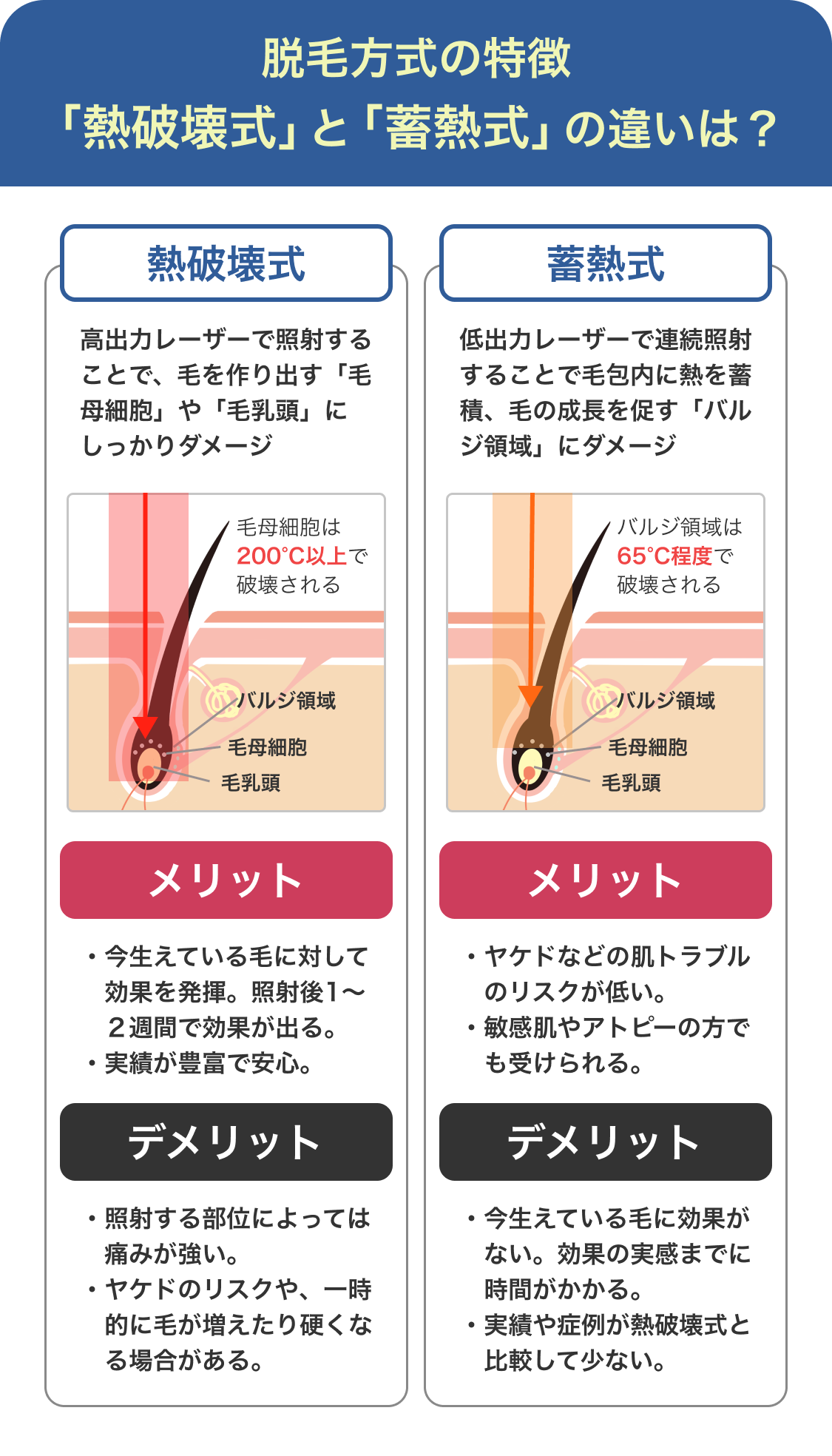 医療レーザー脱毛、熱破壊式と蓄熱式のちがい