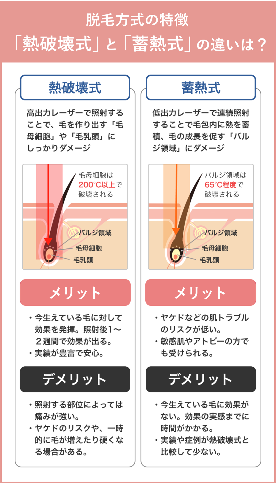 レーザー機器の種類で選ぶ