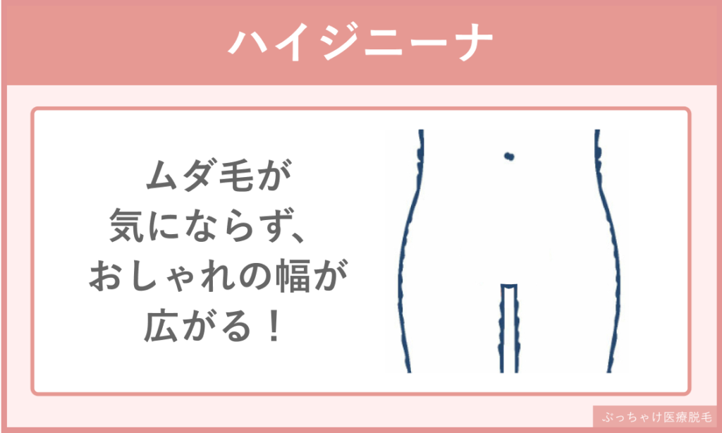 レディース脱毛_VIO_ハイジニーナ