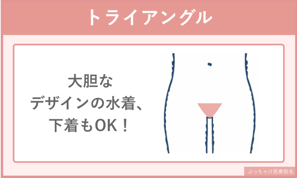 レディース脱毛_VIO_トライアングル
