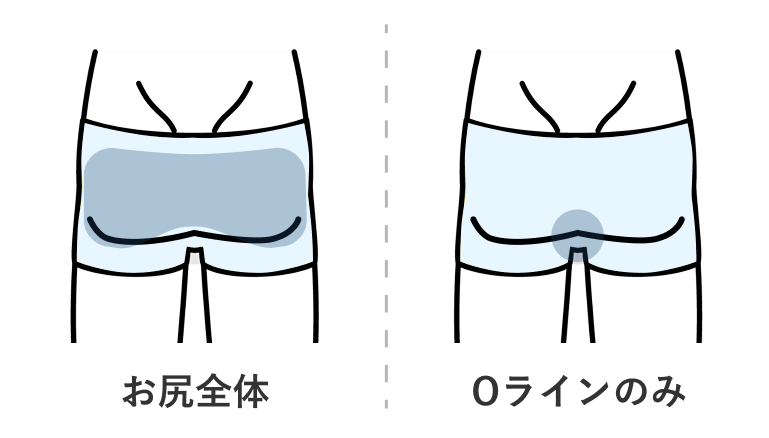 お尻脱毛とOライン脱毛の違い