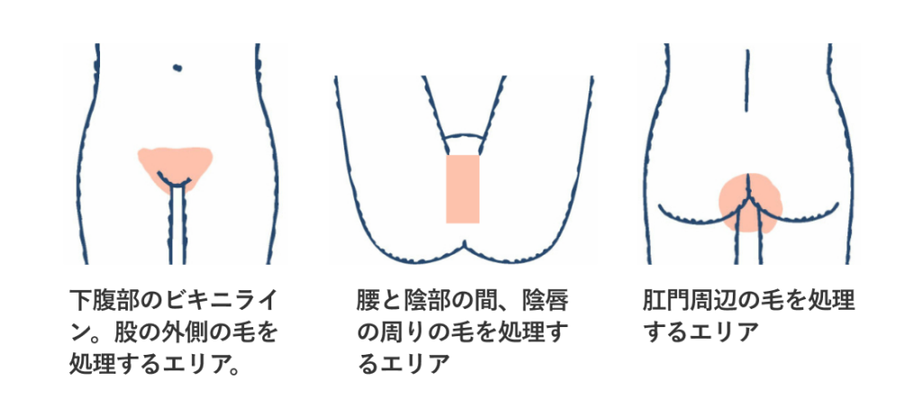レディース脱毛_VIO_部位