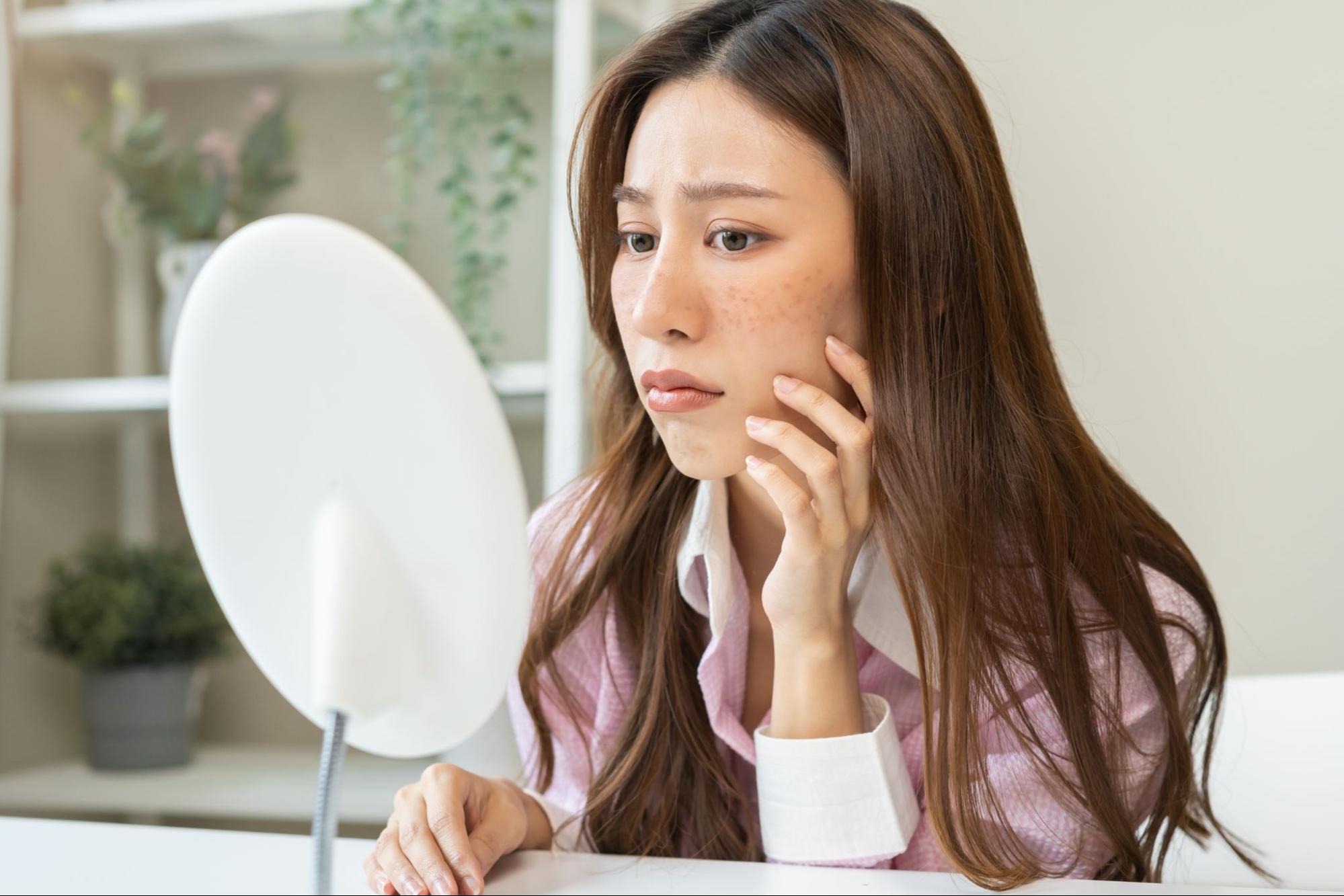 シミを気にする女性