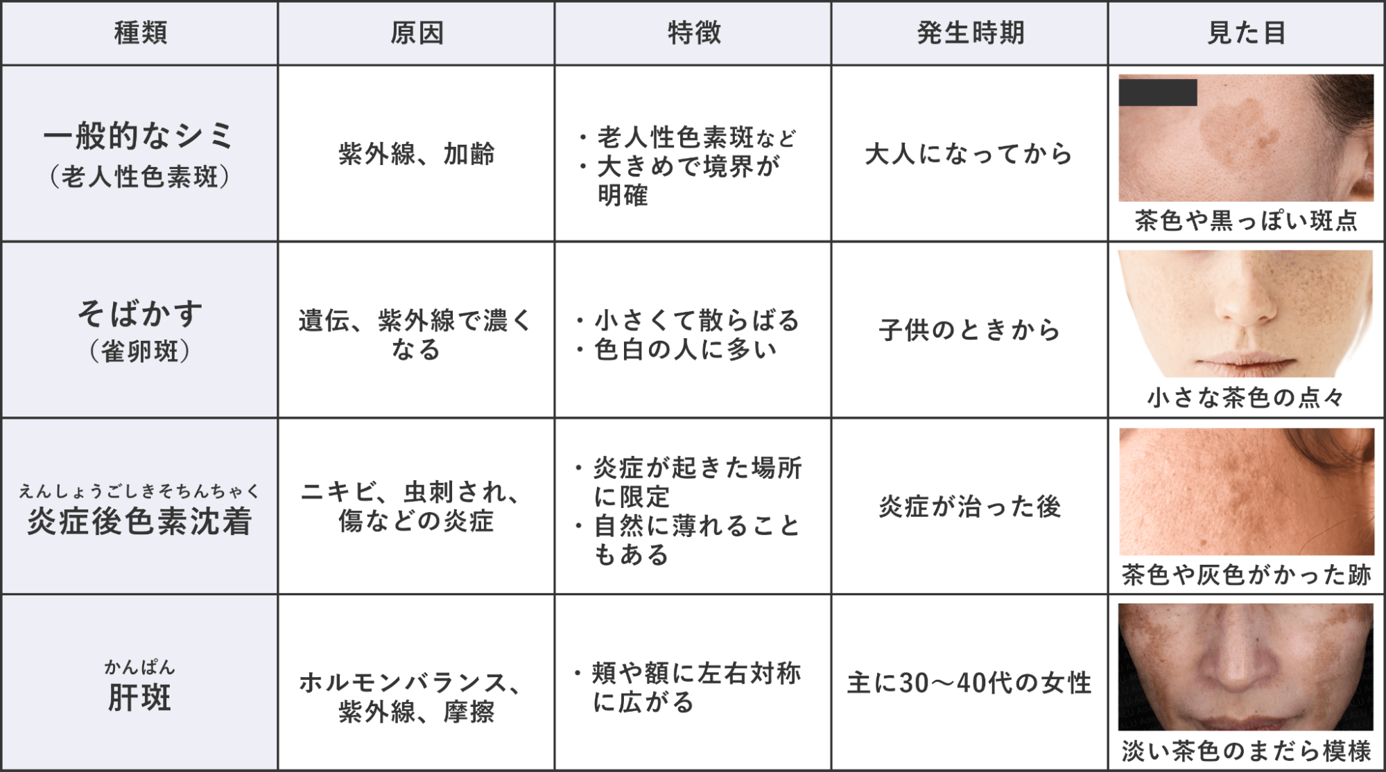 シミと他の肌トラブルとの違い