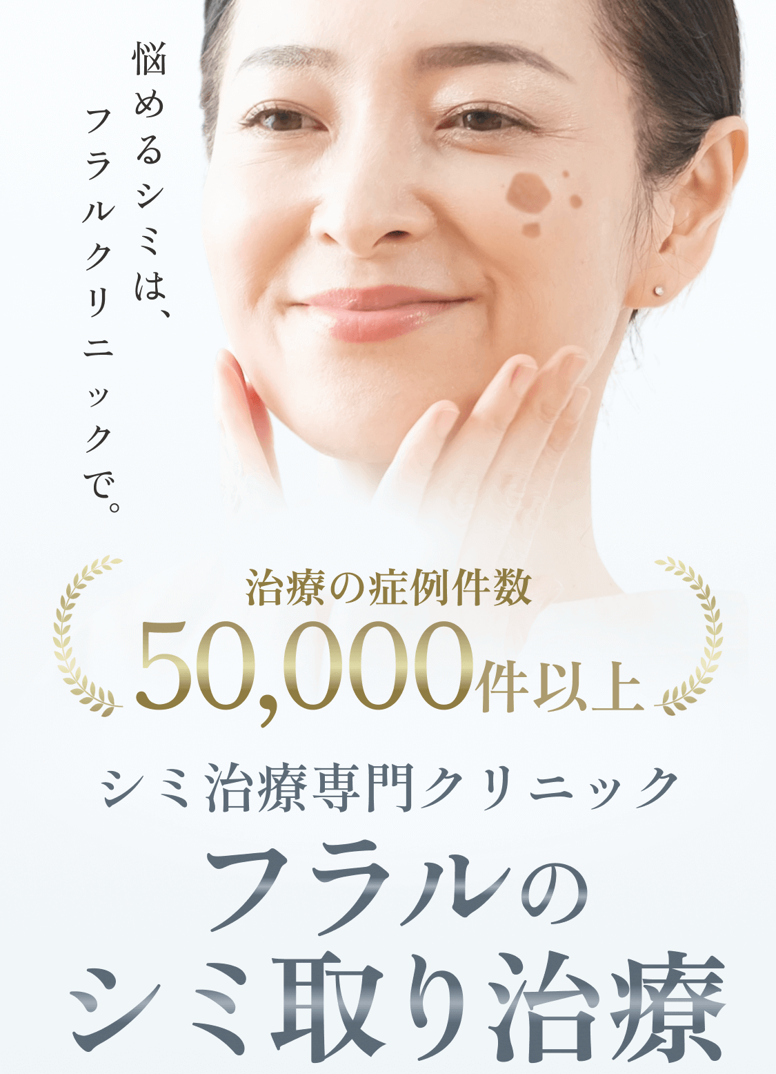 悩めるシミは、美容皮膚科で。フラルのシミ取り治療