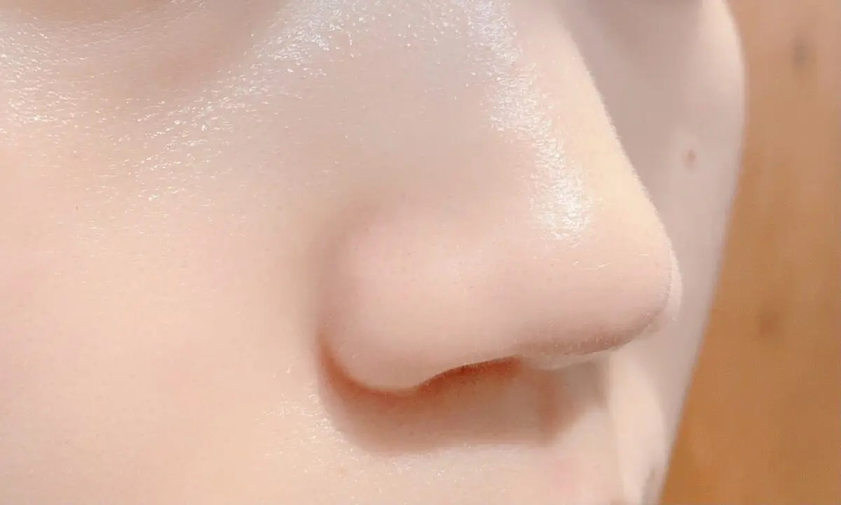 メラニン毛穴