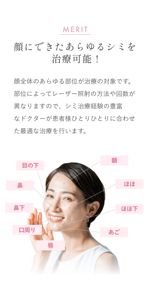 東京でシミ取りレーザー、シミ治療する流れ