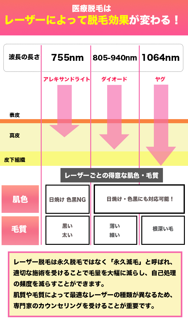 顔脱毛におけるレーザーごとの種類