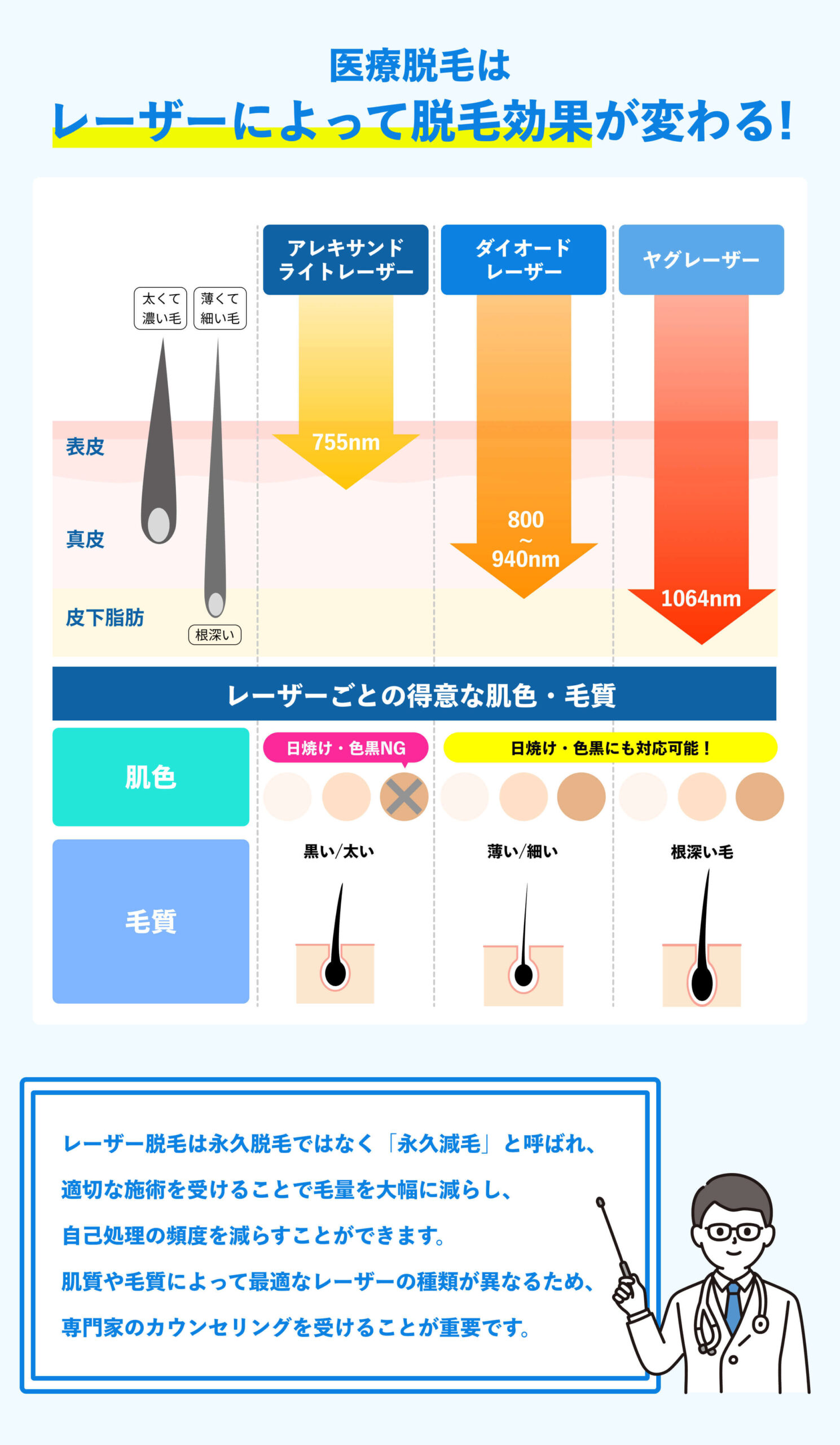 脱毛レーザーの種類