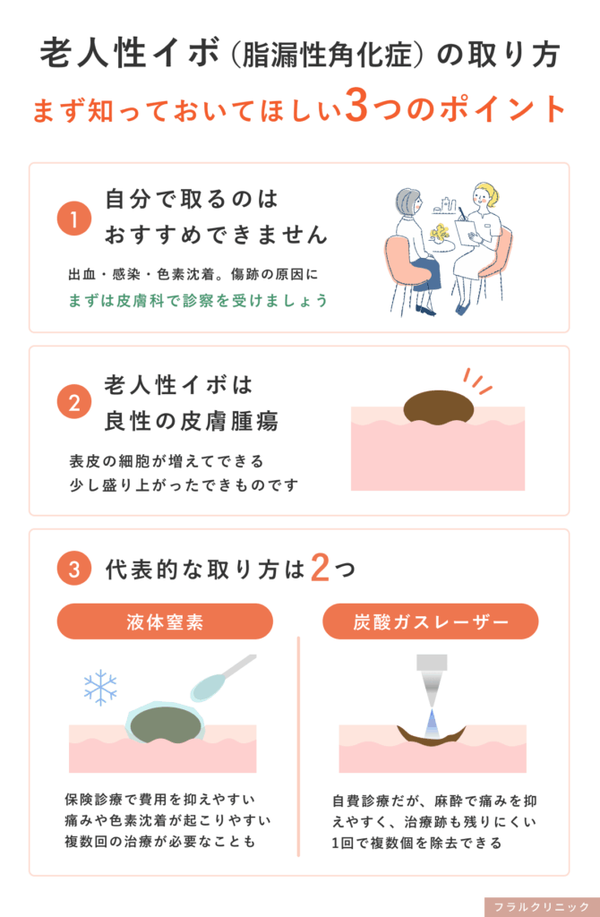1_老人性イボ（脂漏性角化症）の取り方で、まず知っておいてほしい３ポイント_脂漏性角化症