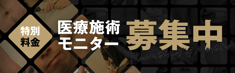 ゴリラクリニックのお得な制度・サービス