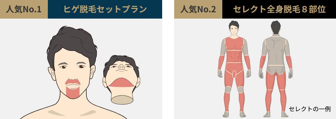 ゴリラクリニックのプラン料金