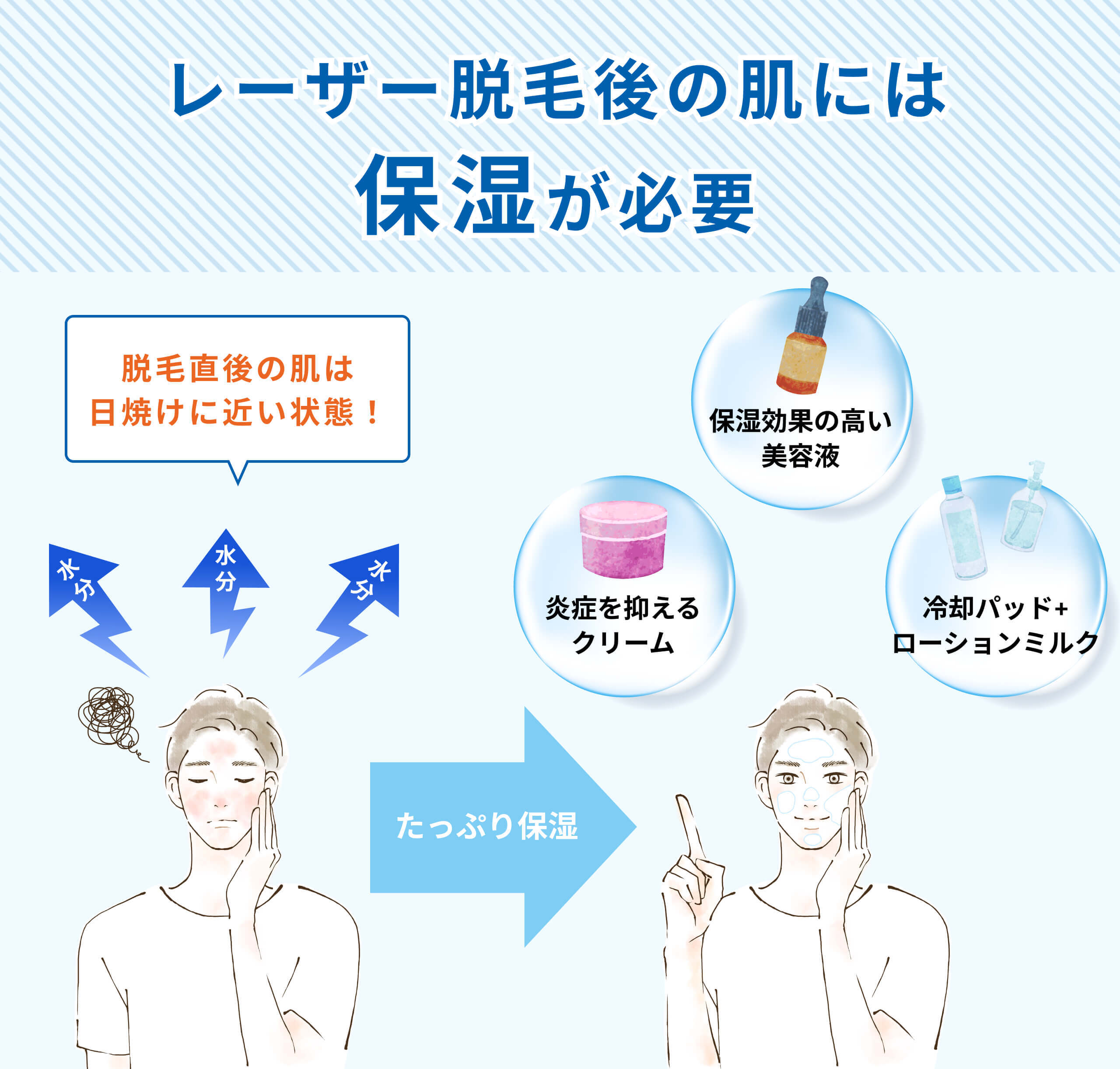 メンズ脱毛　脱毛後の保湿