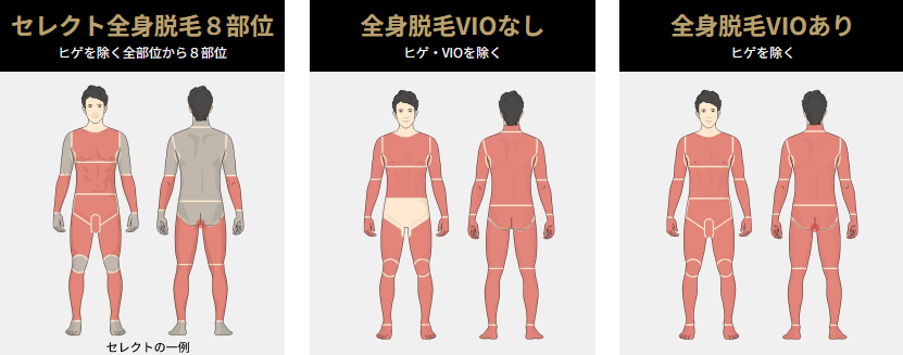 ゴリラクリニックの全身脱毛料金