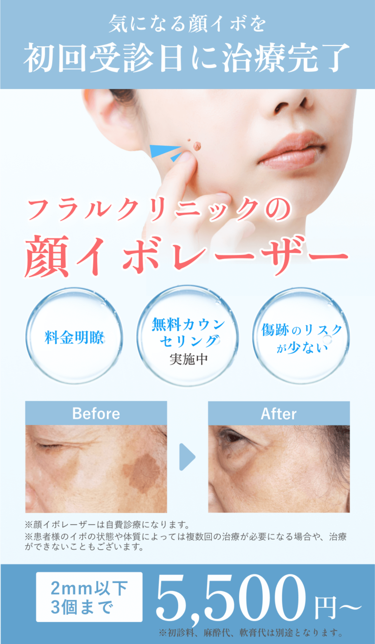 フラルクリニック顔イボ治療
