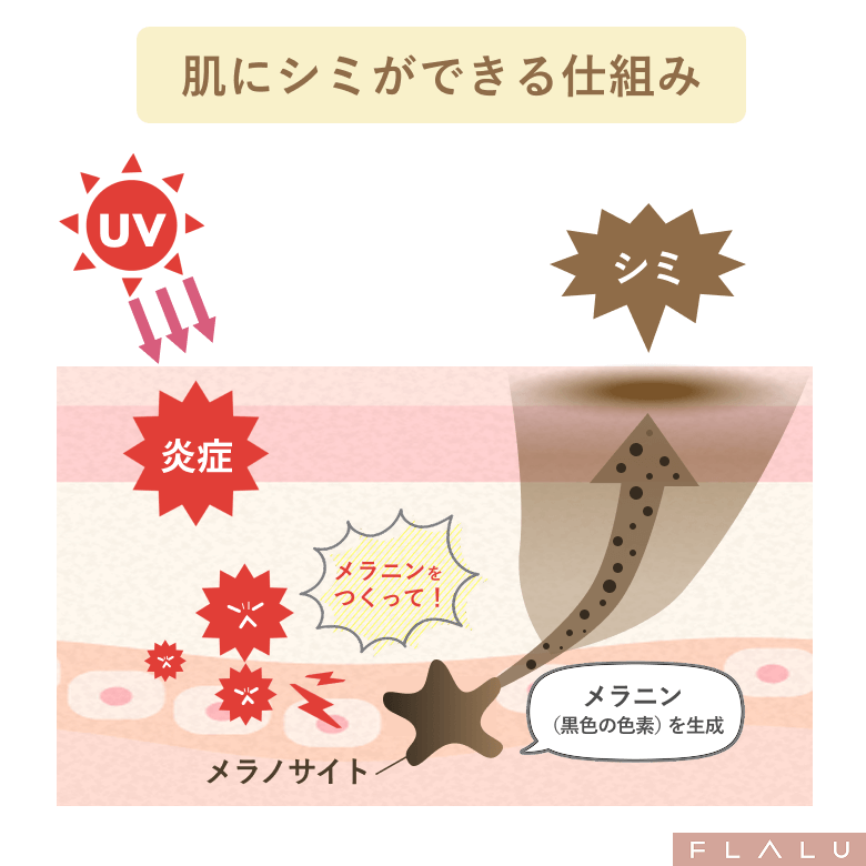 初めてのシミ治療_シミのメカニズム_250925
