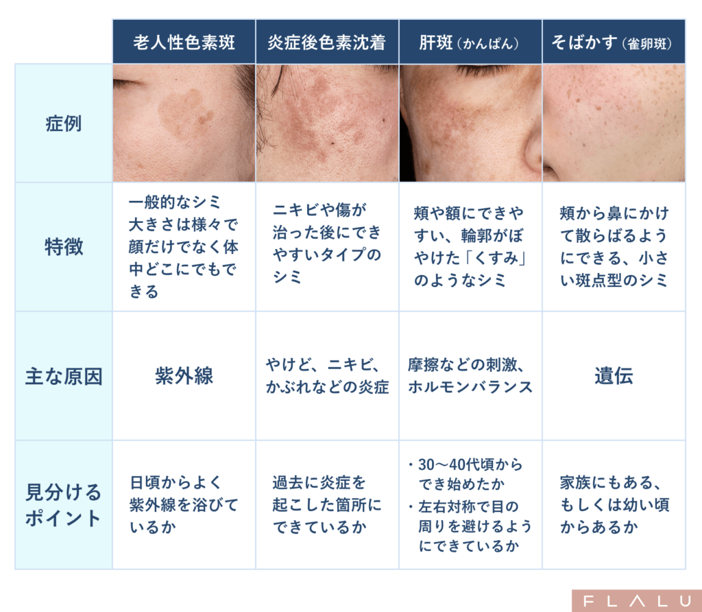 初めてのシミ治療_シミの種類一覧_251017