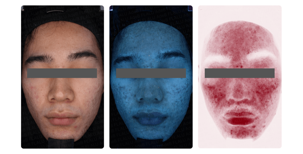 初めてのシミ治療_レビュー写真_251007