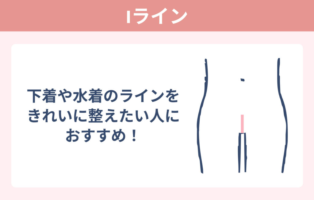 ハイジニーナ脱毛デザイン_Iライン
