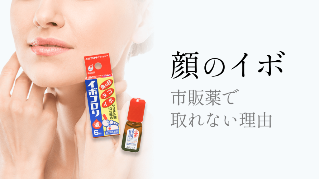 顔のイボが市販薬で取れない理由と正しい治療法