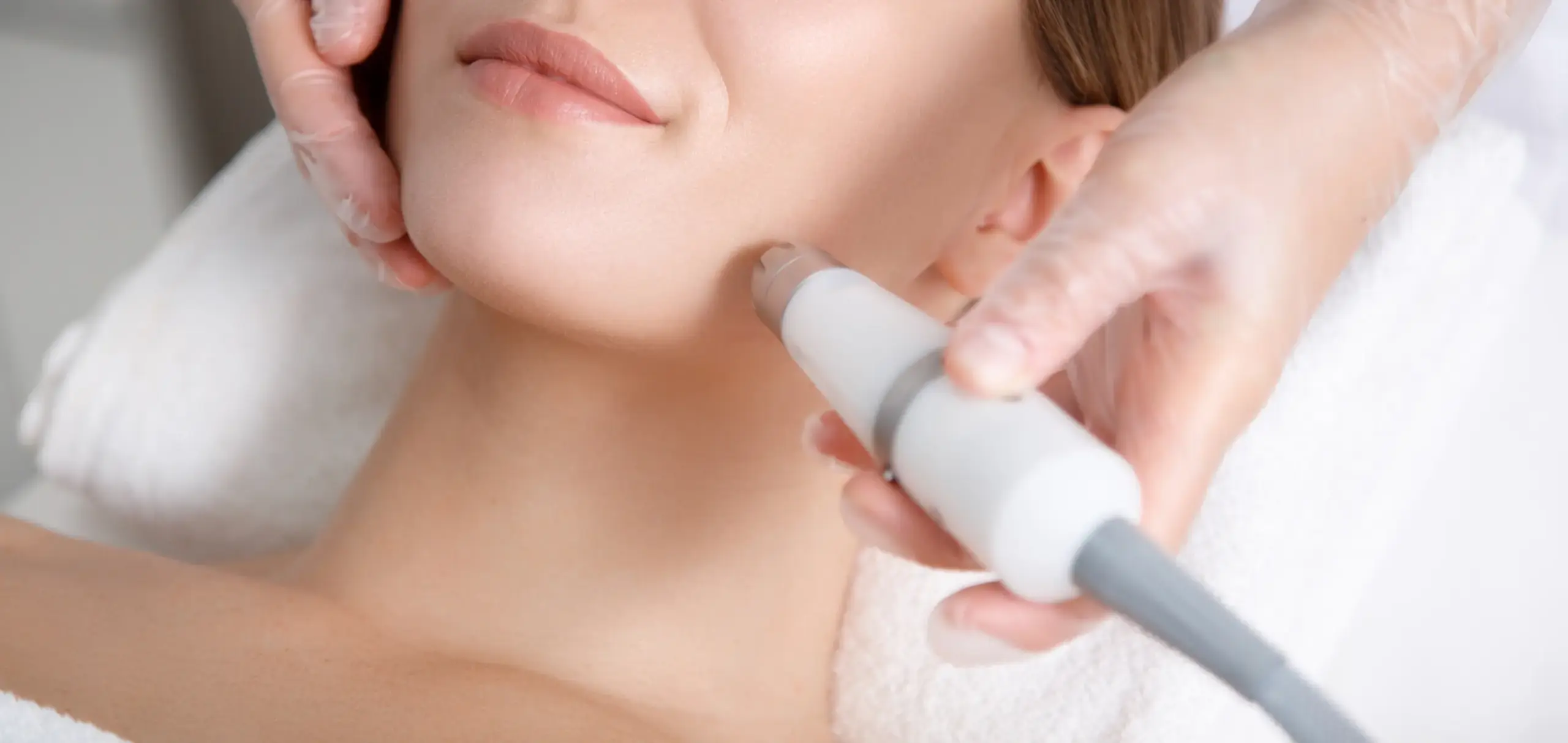 医療レーザー脱毛の施術イメージ