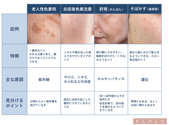 初めてのシミ治療比較表