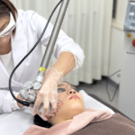 顔イボのレーザー治療を正しく理解するために