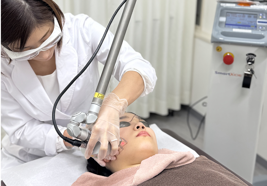 顔イボのレーザー治療｜機器の種類と特徴・治療経過やダウンタイムを解説【医師監修】