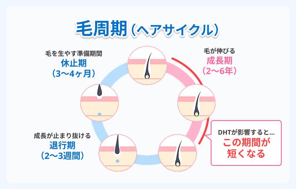 DHT（ジヒドロテストステロン）によって毛周期が乱れるイメージ