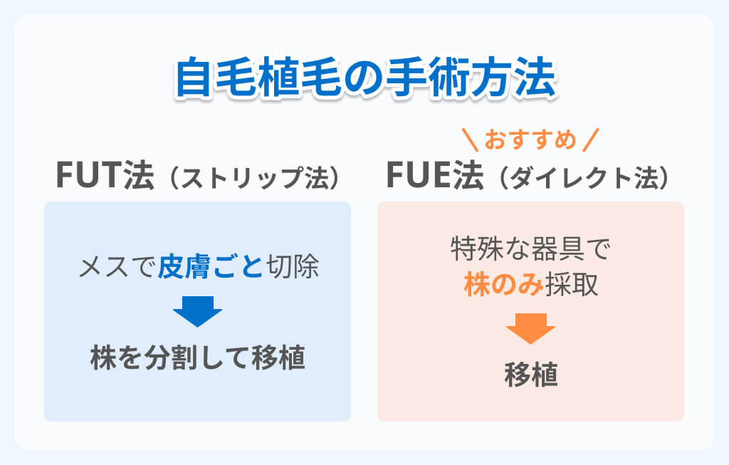 自毛植毛の手術方法は主に2つ！特徴とダウンタイム目安のイメージ