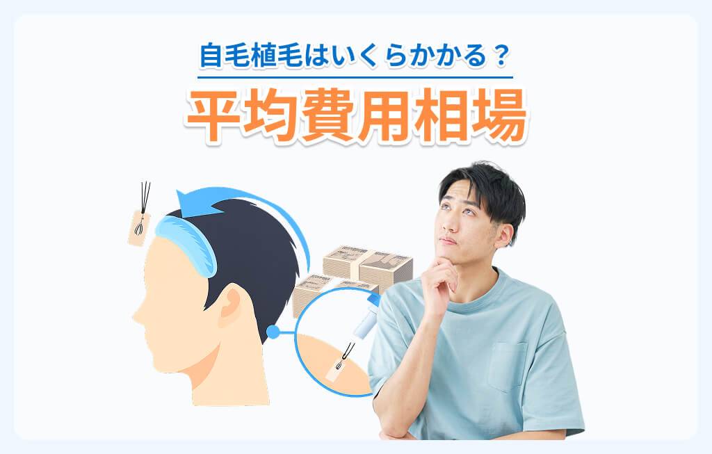 自毛植毛の価格はいくら？平均費用相場のイメージ