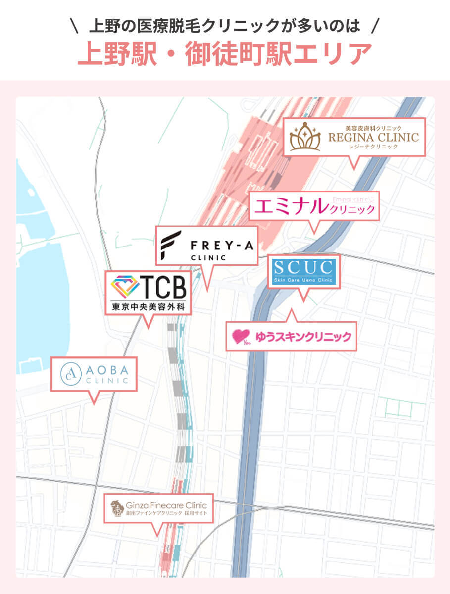 上野の医療脱毛クリニックがあるエリア