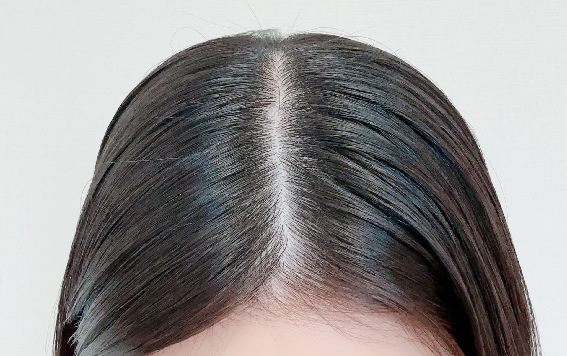 「FAGA」ではない正常な髪の毛の女性イメージ