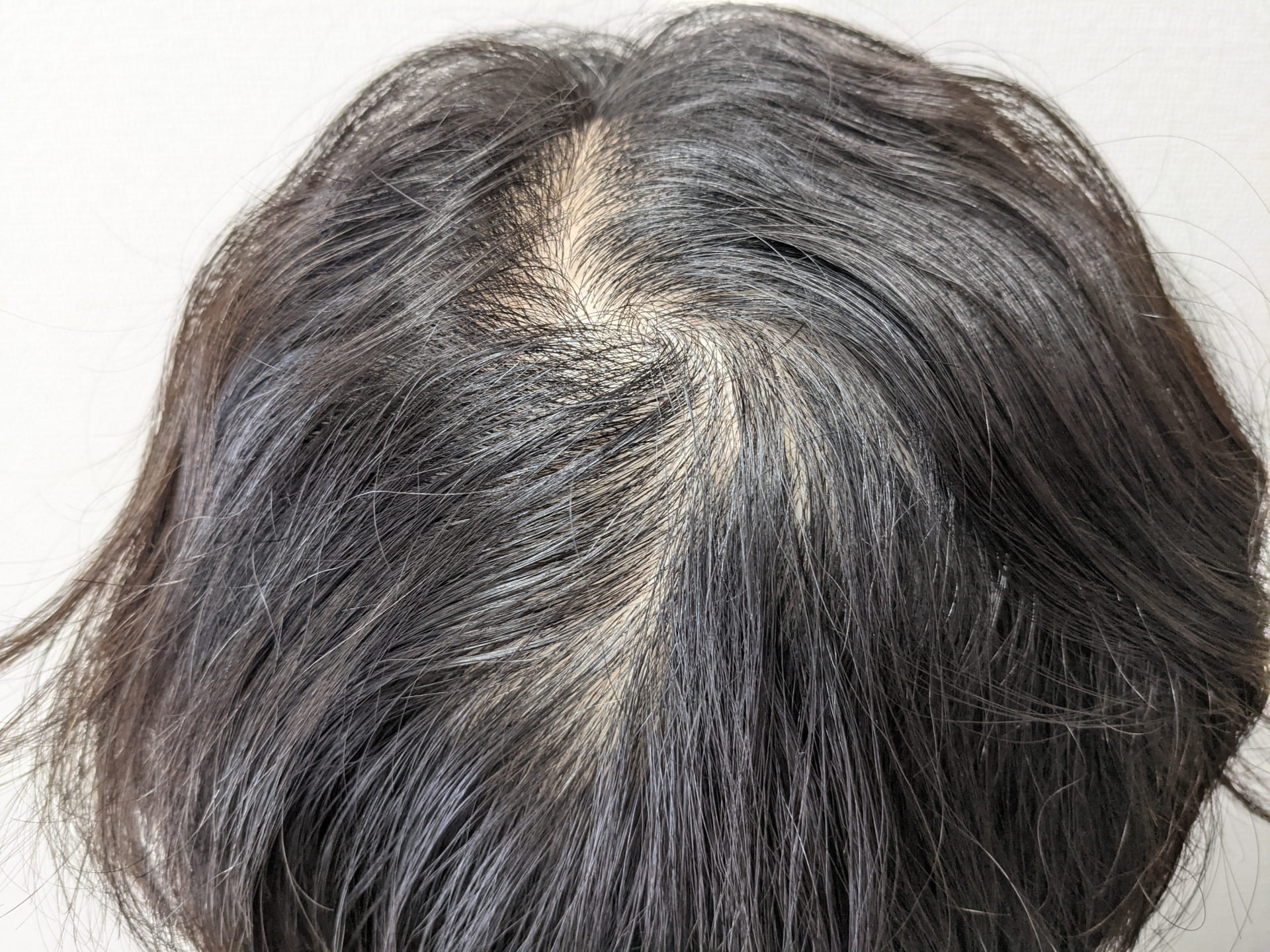 つむじ割れになっている男性のイメージ