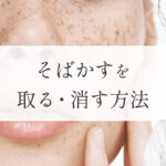 そばかすを取る・消す方法_251221 1