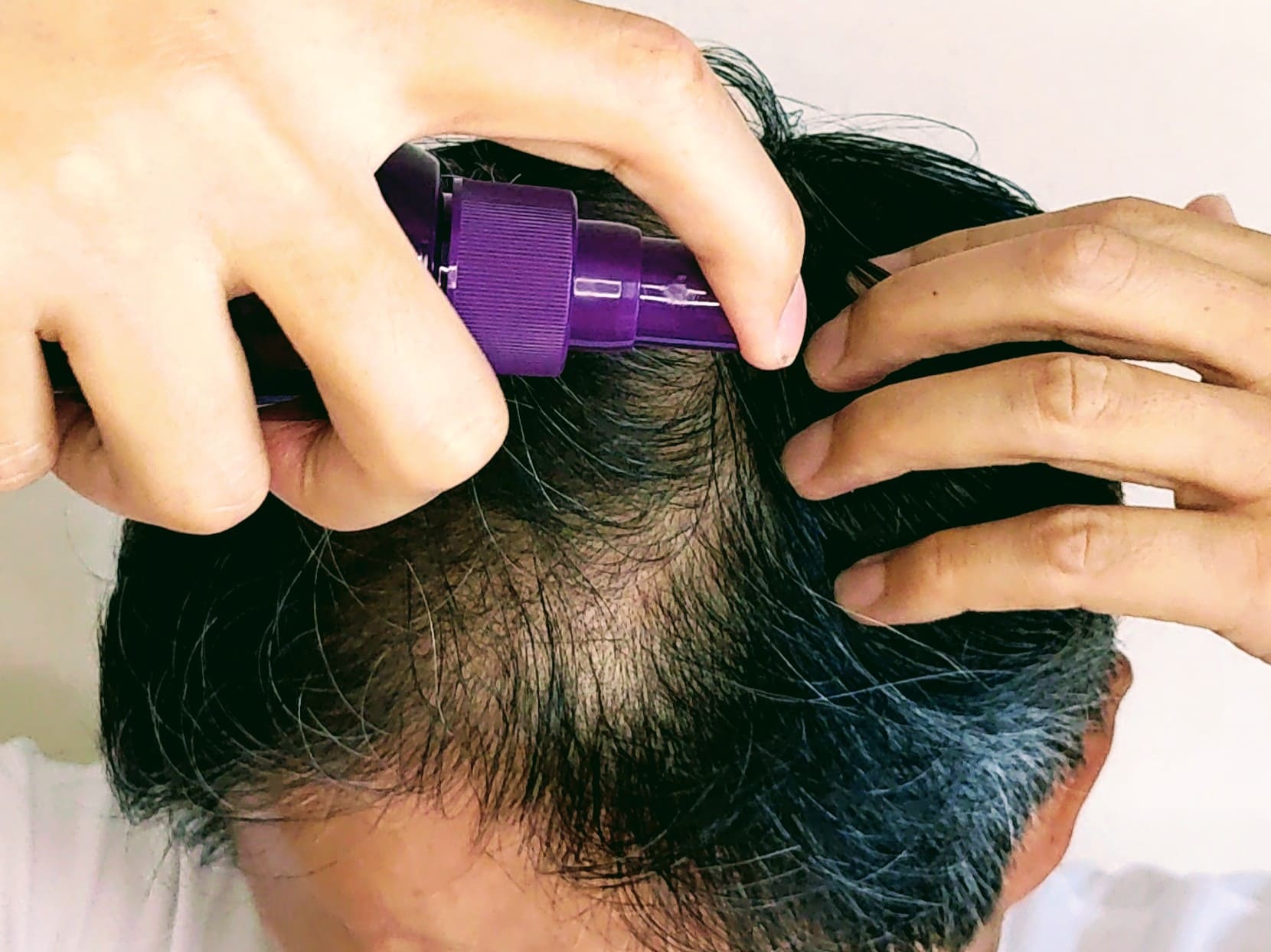 育毛剤で髪を増やそう・生やそうとする男性イメージ