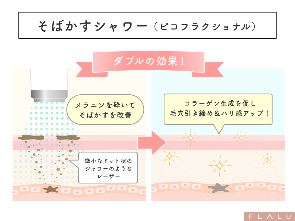 そばかすを消す・取る方法_そばかすシャワー