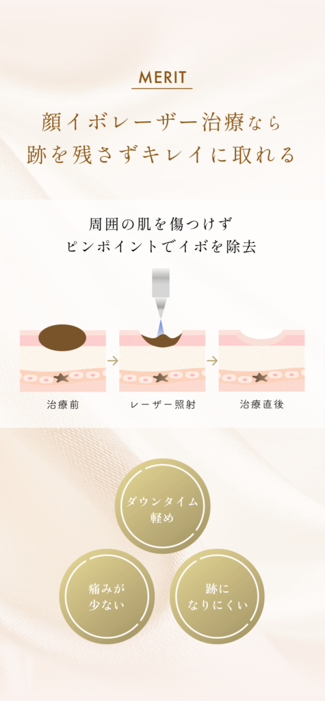 顔イボリスティング_4_251223