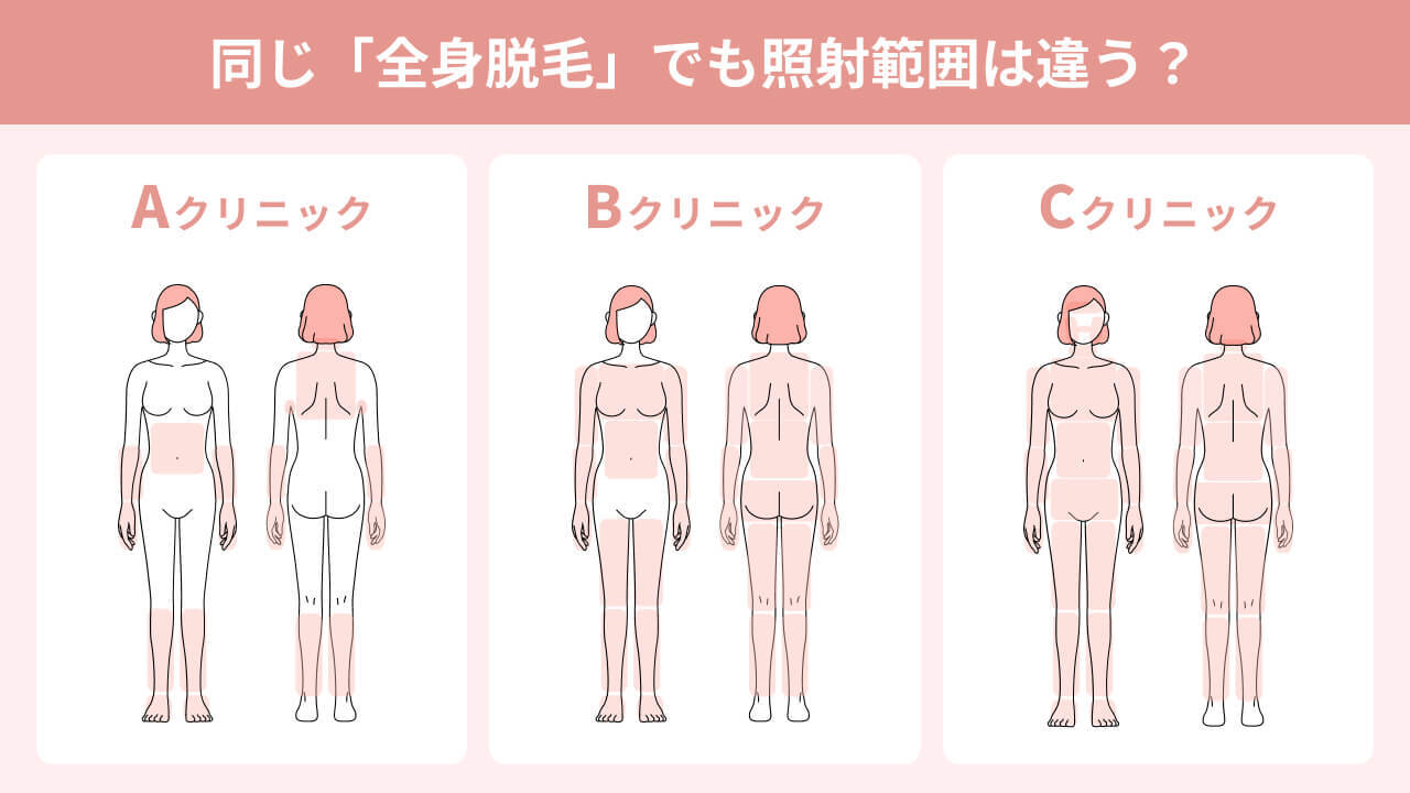 照射範囲の違い