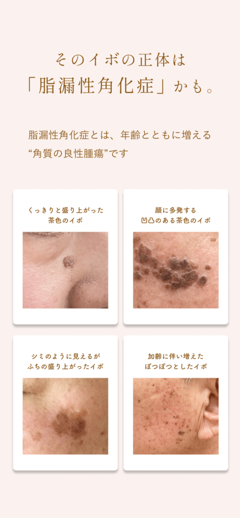 顔イボリスティング_3_251223