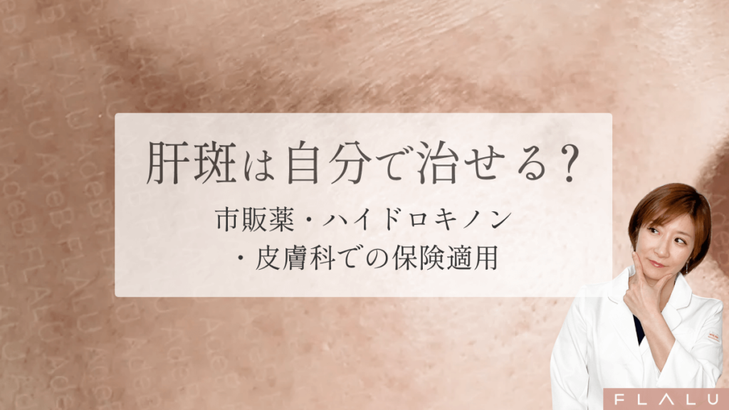 肝斑は自分で治せる？市販薬の使い方と正しい治療の順番を解説【医師監修】