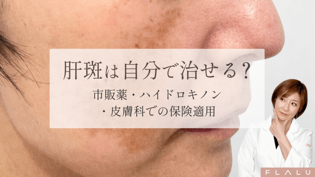 MV_肝斑は自分で治せる?_260215