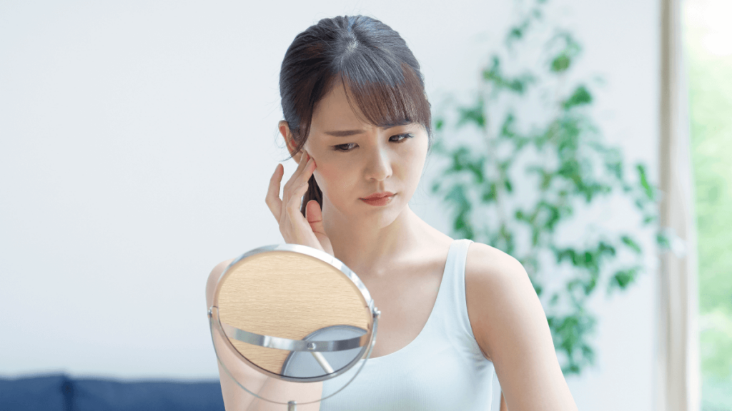 肝斑記事_肝斑ができる理由と悪化を招きやすい要因